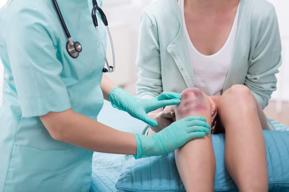 10 cách làm tan máu bầm nhanh chóng tại nhà